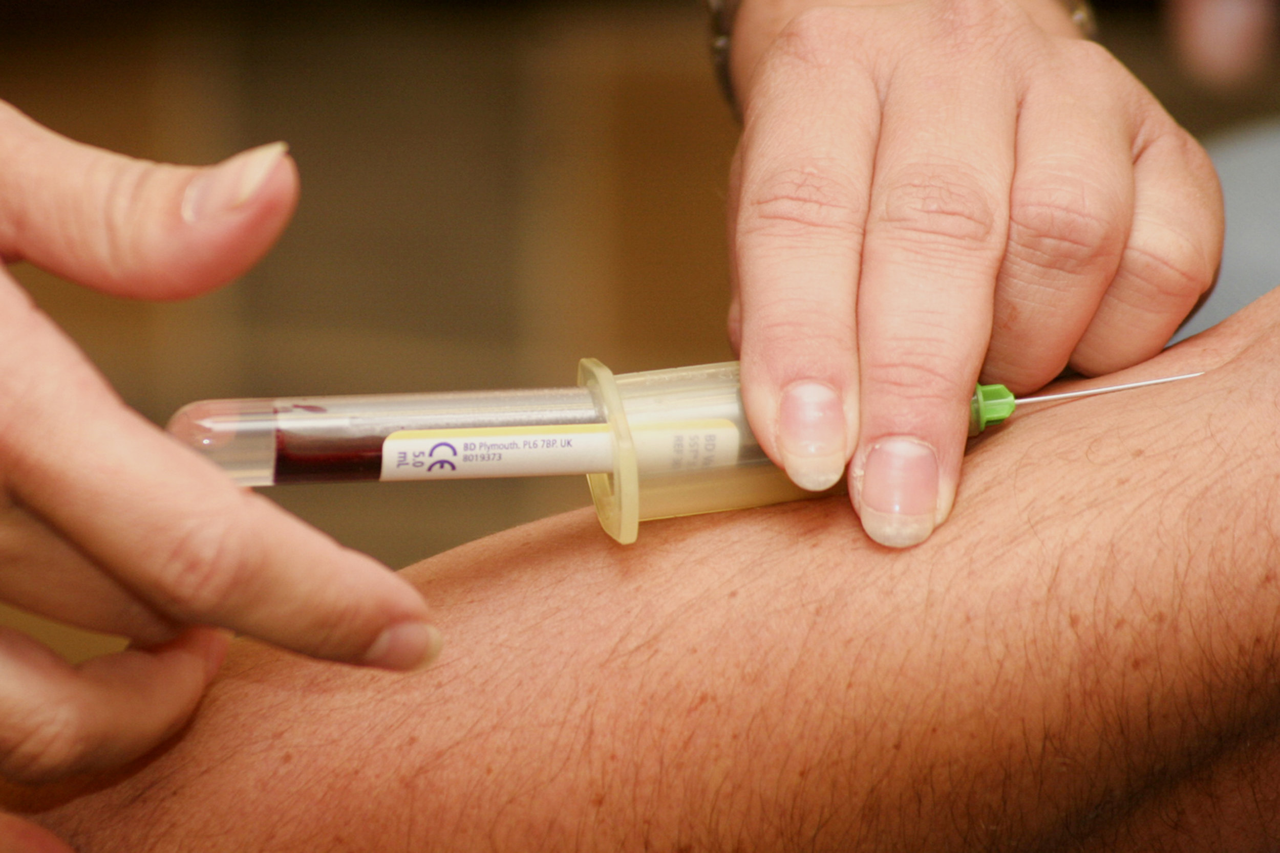 9 Tips That Will Improve Your Next “Stick” (Blood Draw or IV Start